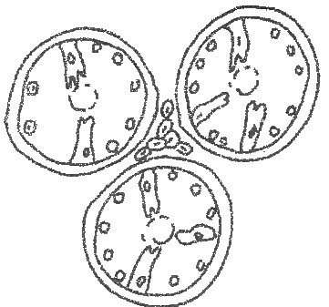 Coupe de testicule cryptorchide : trois tubes séminifères à lumière vide, bordés de petites cellules rondes et de cellules allongées, et un amas de cellules entre les tubes
