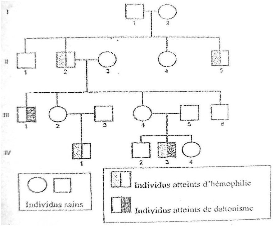 Arbre généalogique sur quatre générations. Génération I : couple sain I1 (homme) et I2 (femme). Génération II : leurs enfants II1 (homme sain), II2 (homme hémophile), II4 (femme saine) et II5 (homme hémophile) ; II2 a pour épouse II3 (femme saine). Génération III : enfants de II2 et II3, III1 (homme daltonien), III2 (femme saine), III4 (femme saine) et III6 (homme sain) ; III3 (homme sain) est l’époux de III2 et III5 (homme sain) celui de III4. Génération IV : IV1 (garçon hémophile), enfant de III2 et III3 ; IV2 (garçon sain), IV3 (garçon hémophile et daltonien) et IV4 (fille saine), enfants de III4 et III5. Légende : individus sains, atteints d’hémophilie (moitié gauche du symbole grisée), atteints de daltonisme (moitié droite grisée).